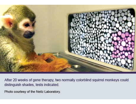 Color Vision Discovery Spurs Clamor And Clinic Uw Medicine Consult
